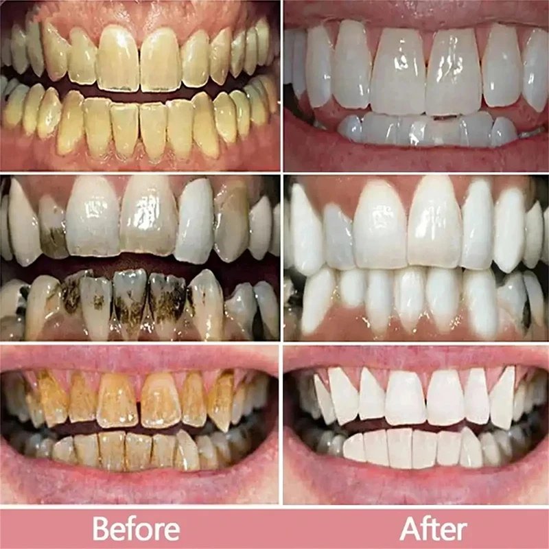 New Teeth Whitening Toothpaste 5D Teeth Whitening Stick Oral Hygiene Cleaning Teeth Whitening Tool Fresh Breath Teeth Care New