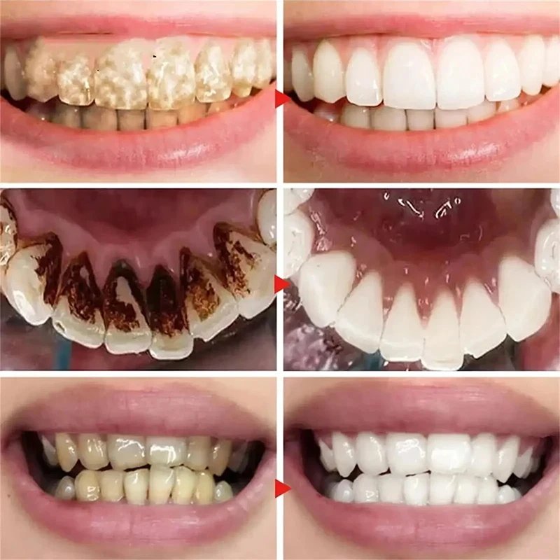 New Teeth Whitening Toothpaste 5D Teeth Whitening Stick Oral Hygiene Cleaning Teeth Whitening Tool Fresh Breath Teeth Care New