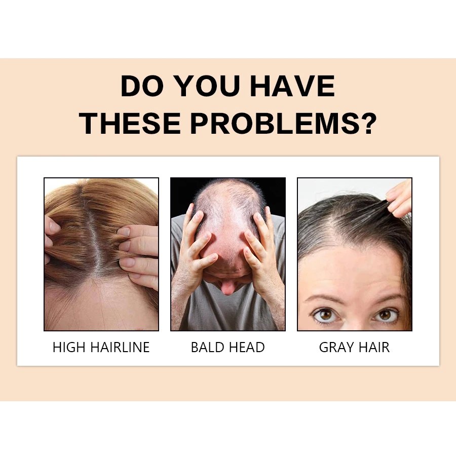 GOIPLE Hair Building Fibers - Image 2